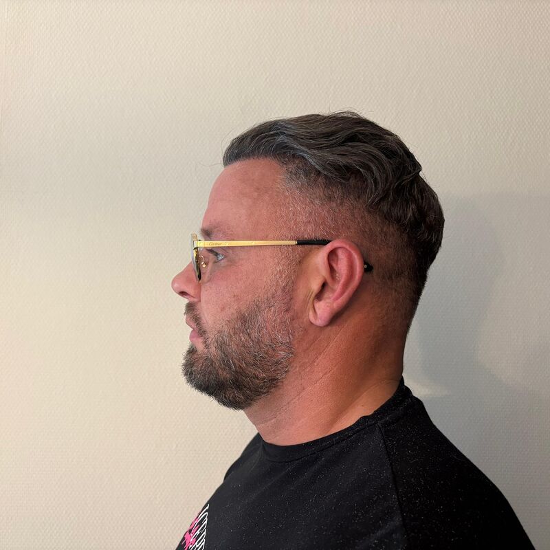Micheal van der Plas baard en herstel haartransplantatie