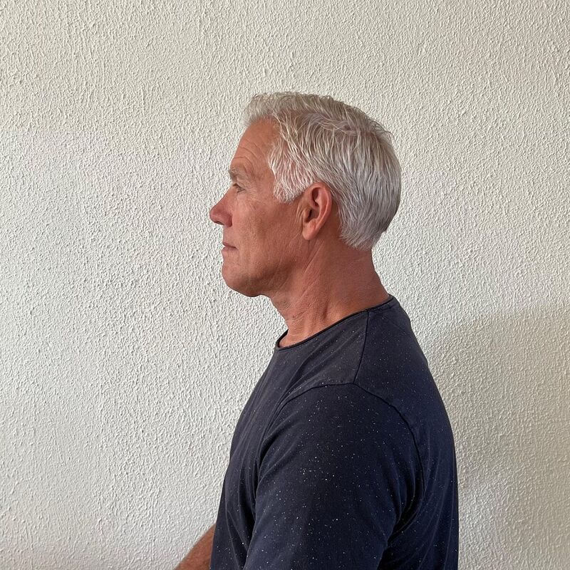 Haartransplantatie ook voor mensen boven de 60