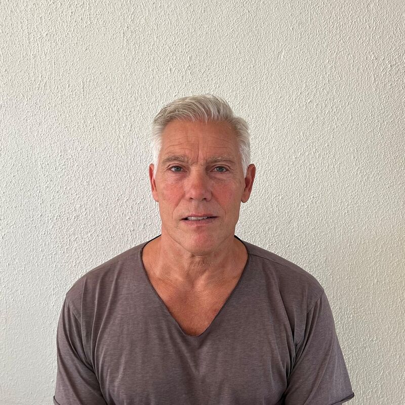 Haartransplantatie ook voor mensen boven de 60