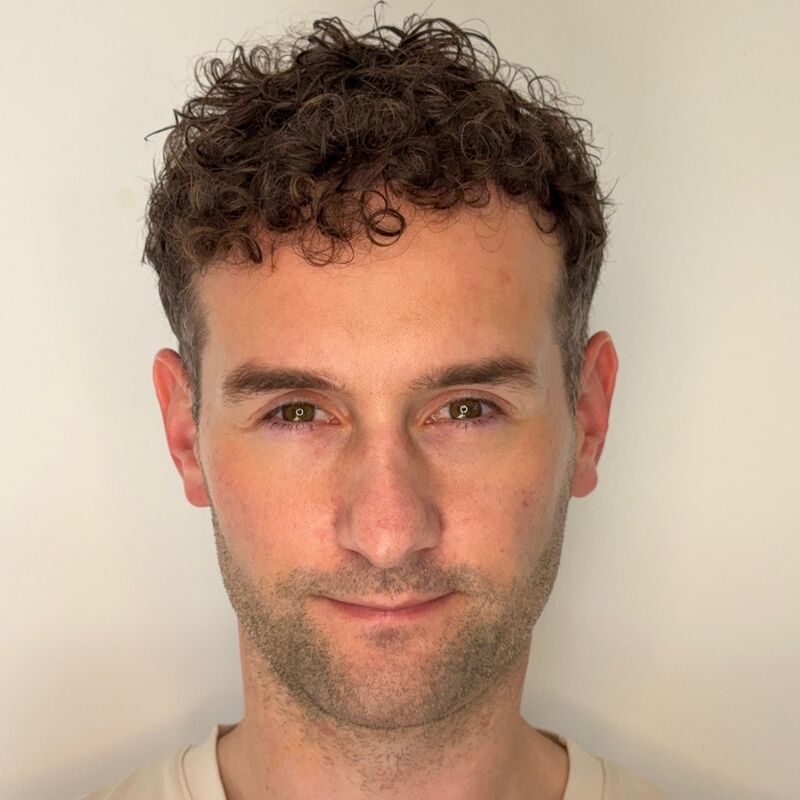 Jorrit stoorde zich al jaren aan die terugtrekkende haarlijn