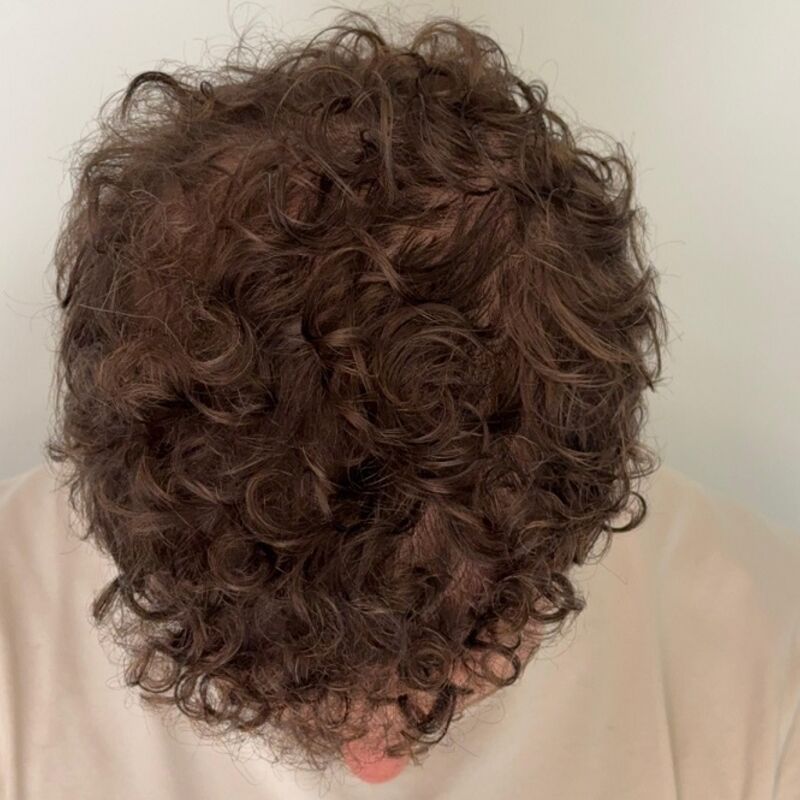 Jorrit stoorde zich al jaren aan die terugtrekkende haarlijn