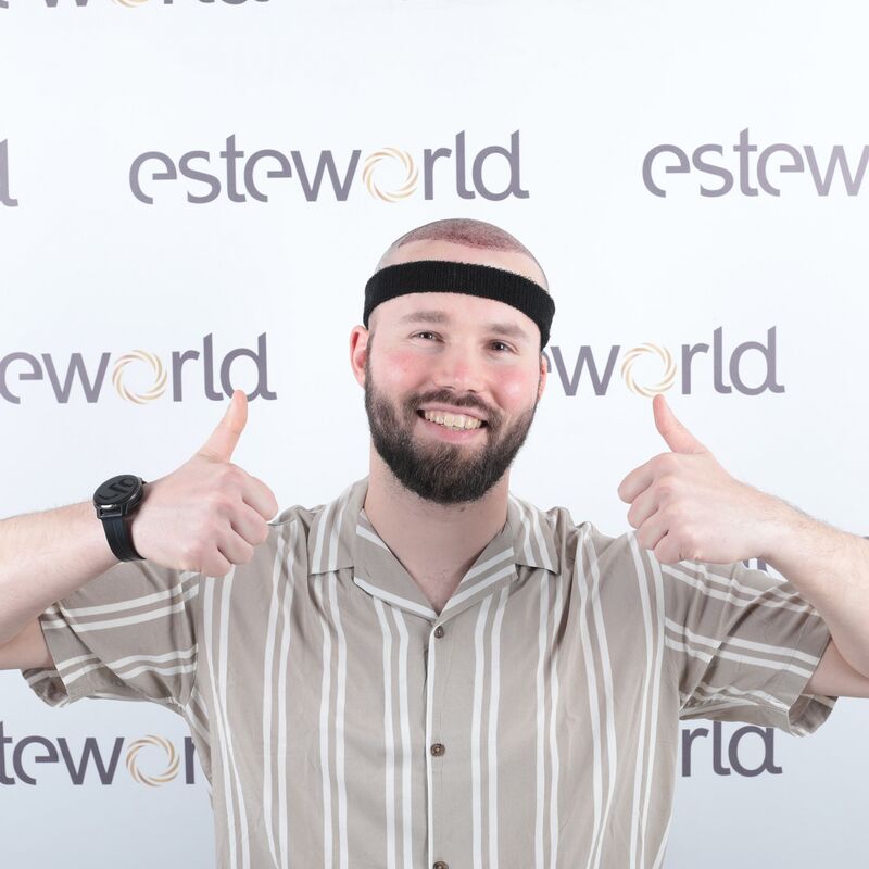 Niels, maak je geen zorgen wat mensen na de haartransplantatie zeggen