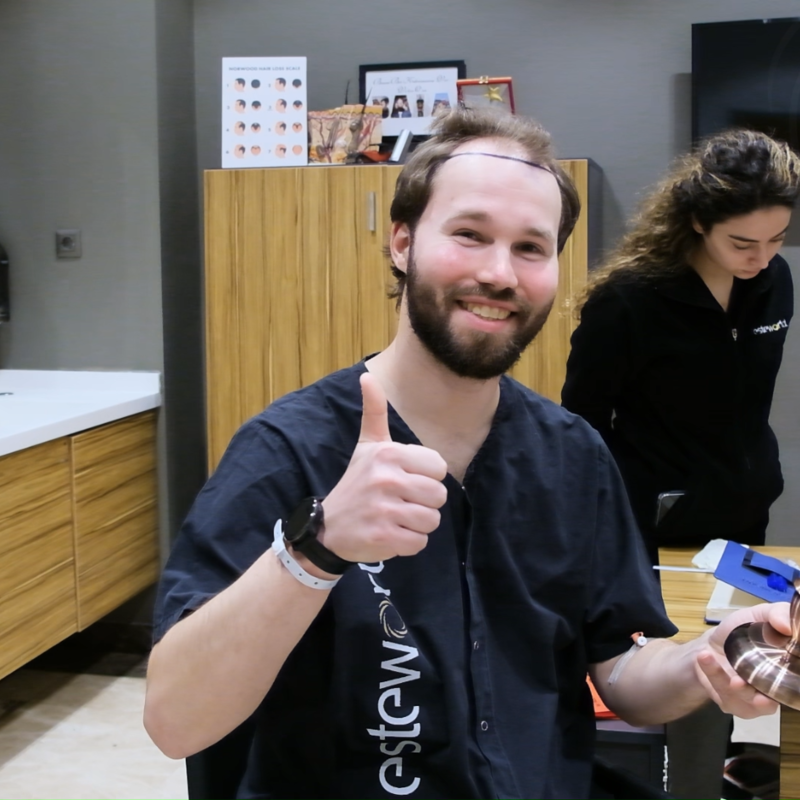 Niels, maak je geen zorgen wat mensen na de haartransplantatie zeggen