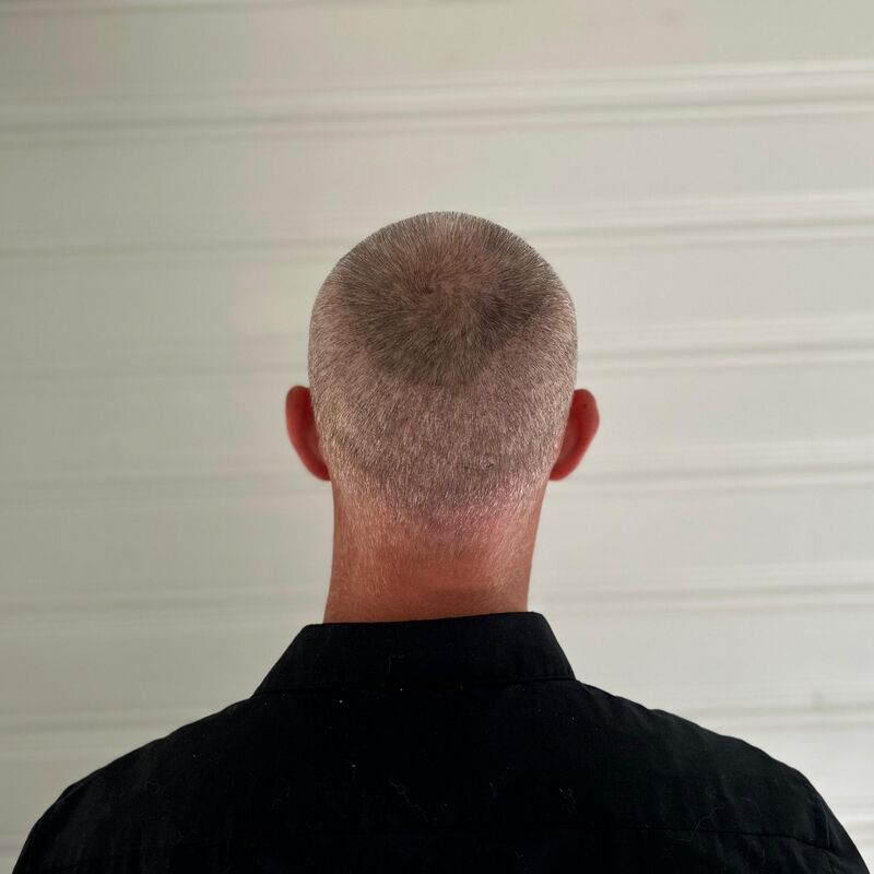 Tim, jarenlang aankijken hoe mijn haar dunner werd