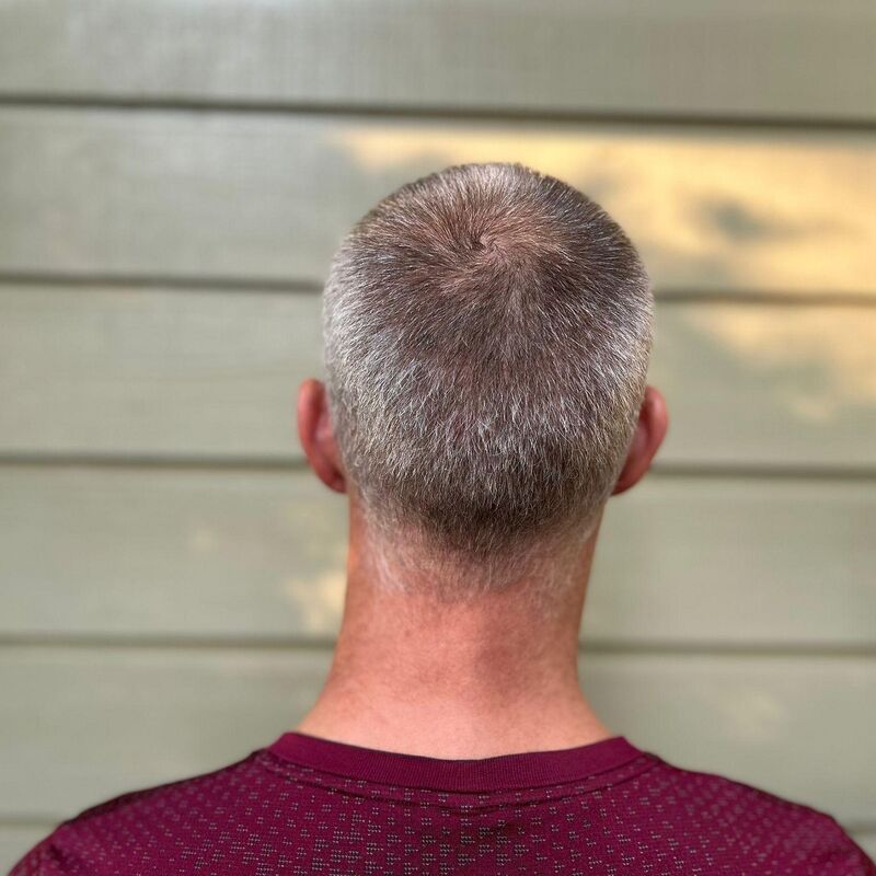 Tim, jarenlang aankijken hoe mijn haar dunner werd