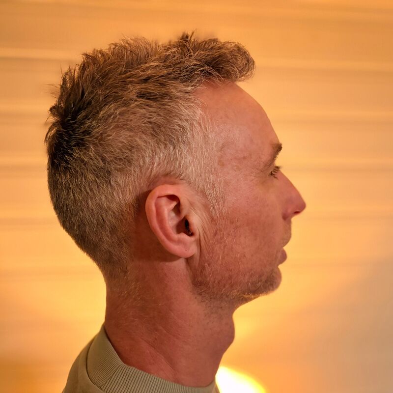 Tim, jarenlang aankijken hoe mijn haar dunner werd