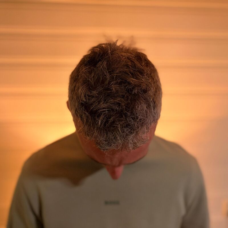 Tim, jarenlang aankijken hoe mijn haar dunner werd