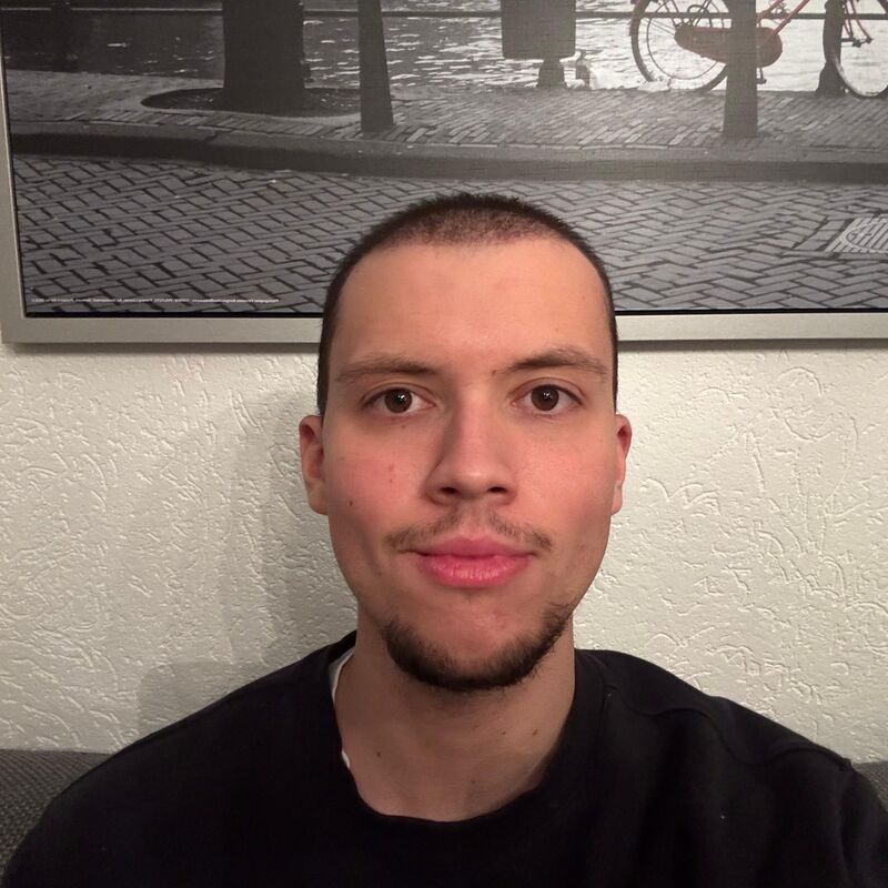 Elnur, mijn haar werd al een tijdje dunner