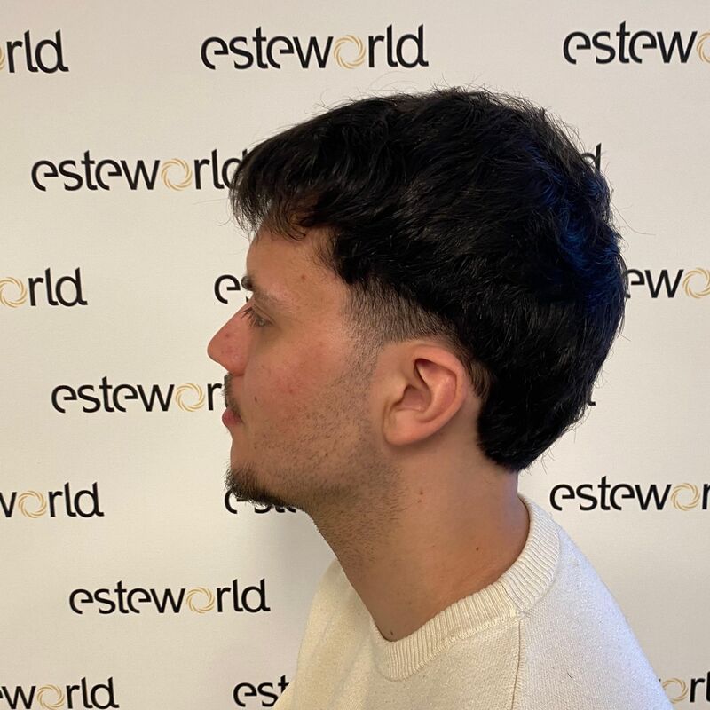 Elnur, mijn haar werd al een tijdje dunner