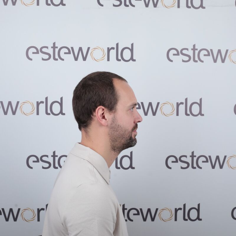 Tom, na verdoezelen met kapsels nu haartransplantatie