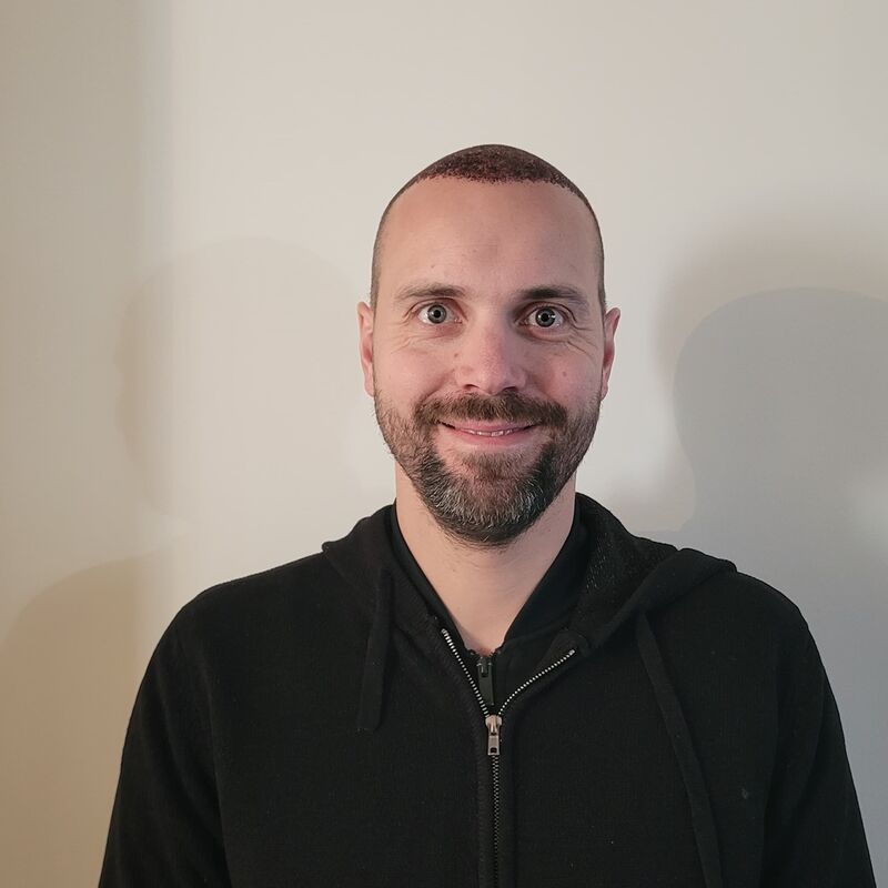 Tom, na verdoezelen met kapsels nu haartransplantatie