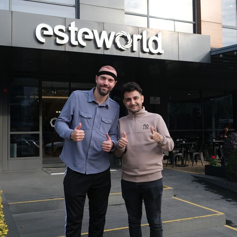 Tom, na verdoezelen met kapsels nu haartransplantatie