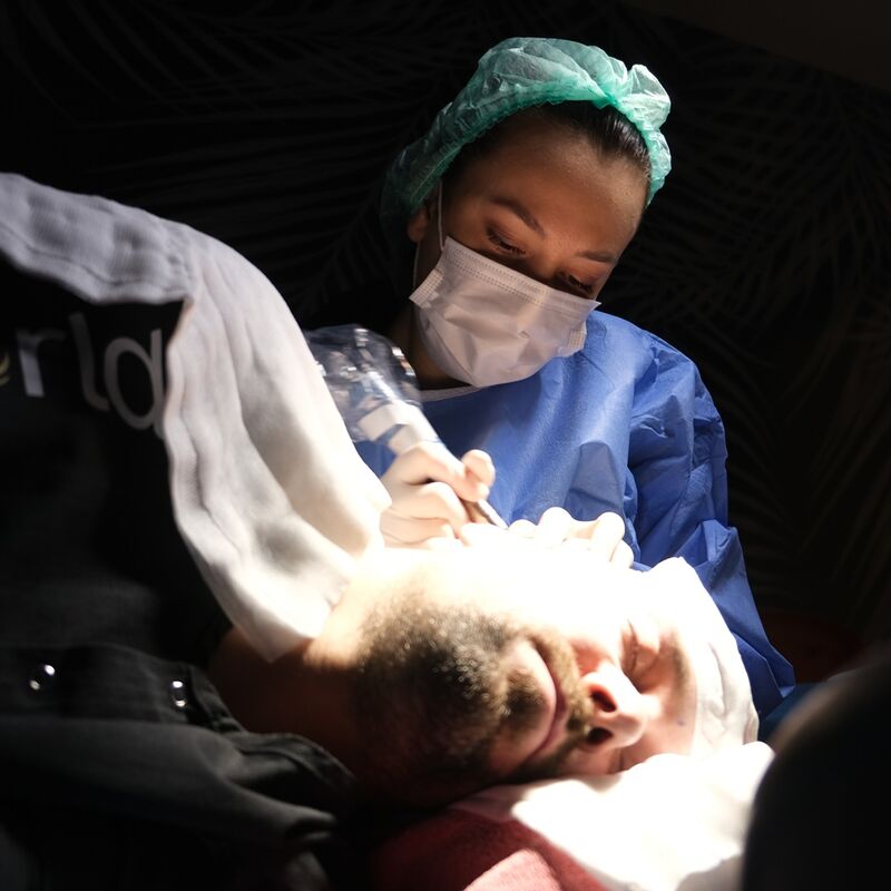 Tom, na verdoezelen met kapsels nu haartransplantatie