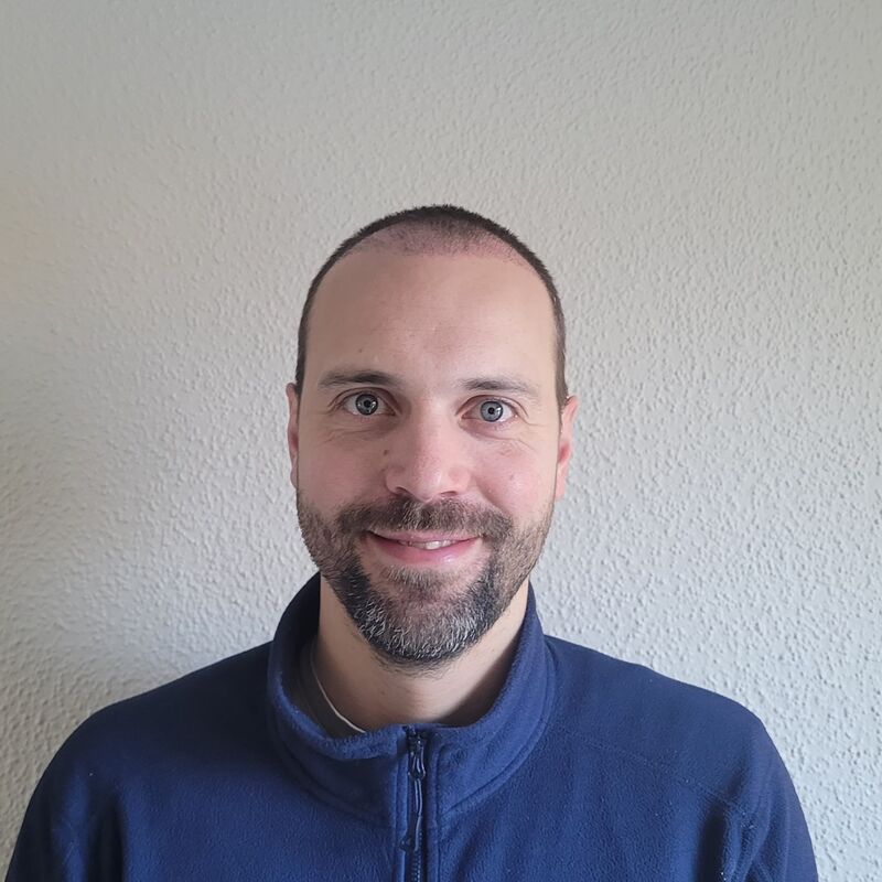 Tom, na verdoezelen met kapsels nu haartransplantatie