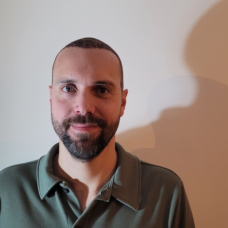 Tom, na verdoezelen met kapsels nu haartransplantatie