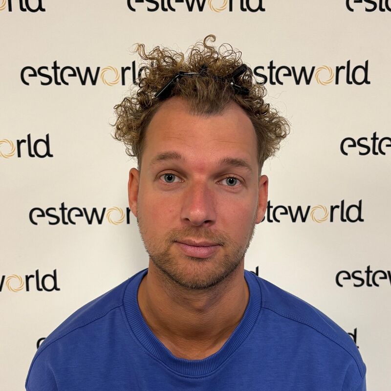 Teus, open en vertrouwelijke haartransplantatie intake in Nederland