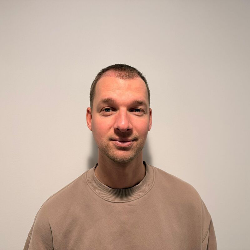 Teus, open en vertrouwelijke haartransplantatie intake in Nederland