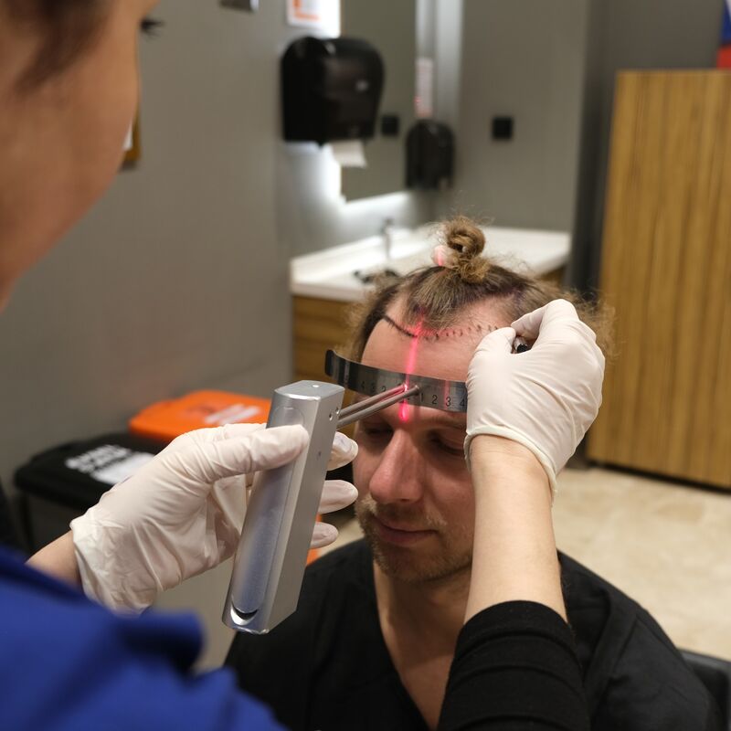 Teus, open en vertrouwelijke haartransplantatie intake in Nederland