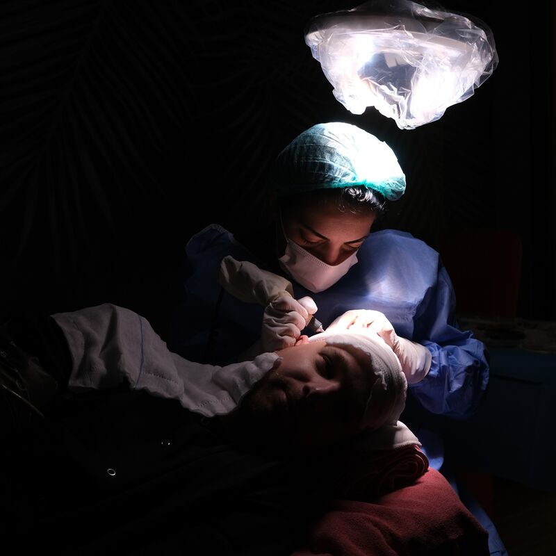 Teus, open en vertrouwelijke haartransplantatie intake in Nederland