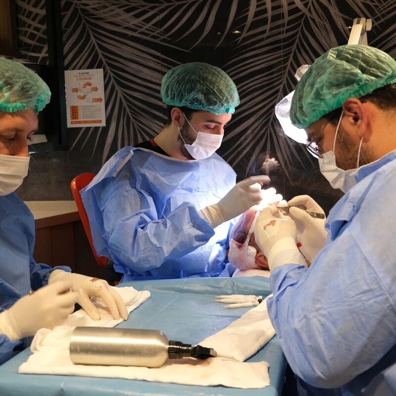 Mijn inhammen werden dieper en dieper. Tijd voor een haartransplantatie