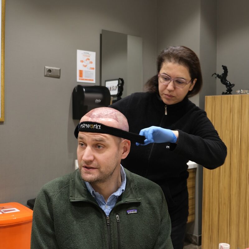 Mijn inhammen werden dieper en dieper. Tijd voor een haartransplantatie