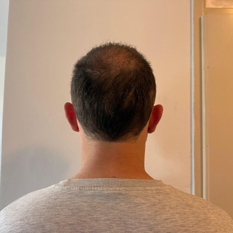 Nino, Pijnloze behandeling en uitstekende (na)zorg