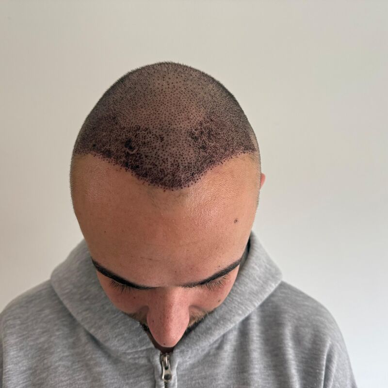 Nino, Pijnloze behandeling en uitstekende (na)zorg