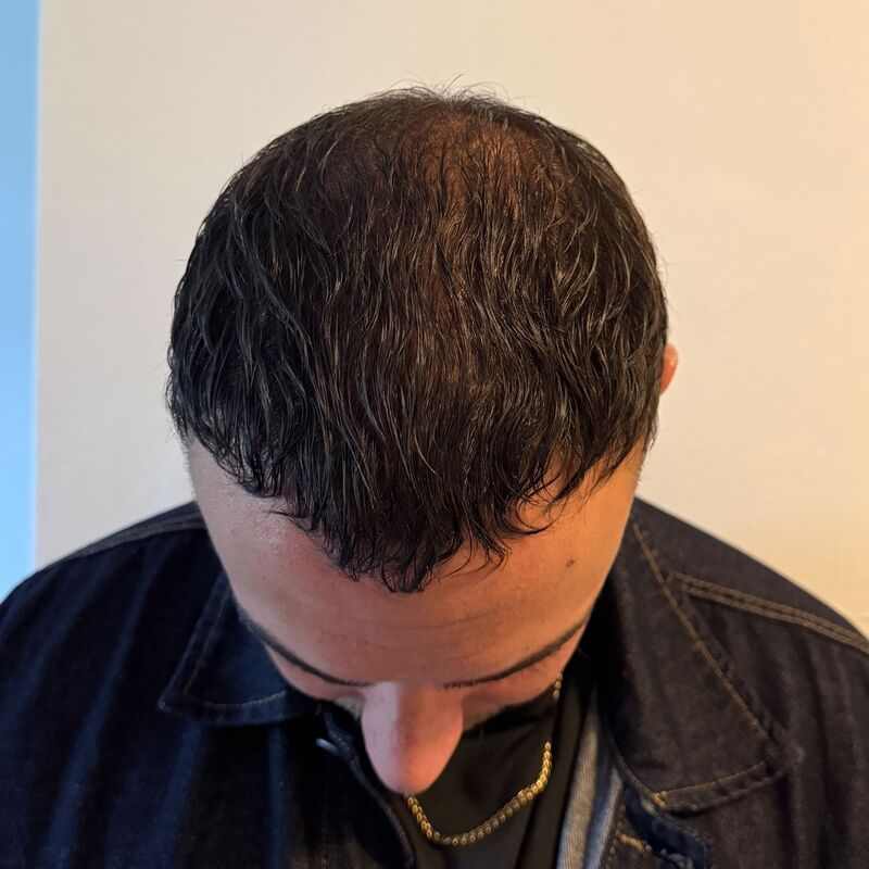 Nino, Pijnloze behandeling en uitstekende (na)zorg