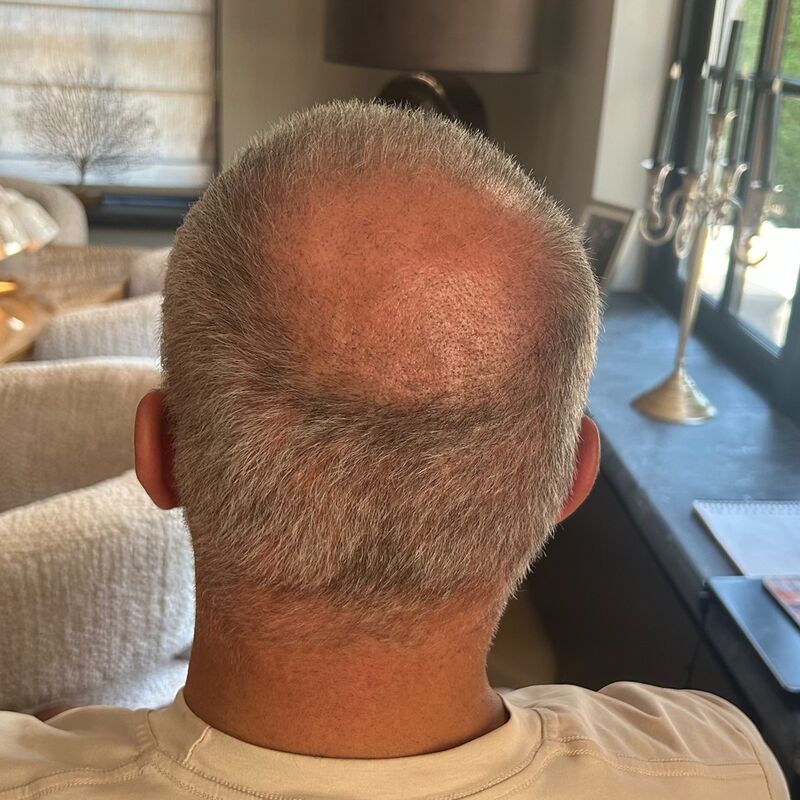 Denny Braaf, eerlijkheid gaf mij direct vertrouwen.