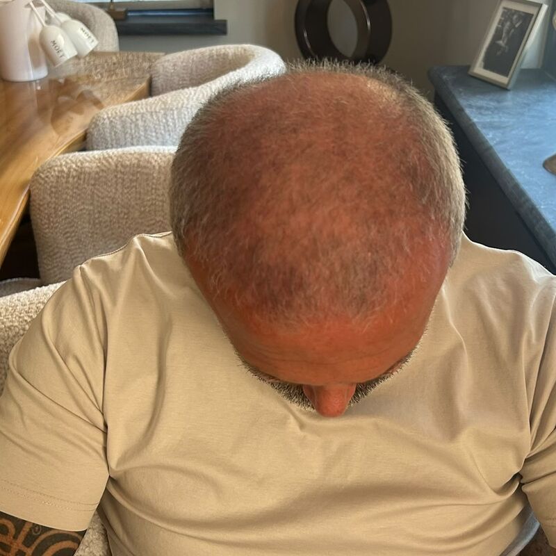 Denny Braaf, eerlijkheid gaf mij direct vertrouwen.
