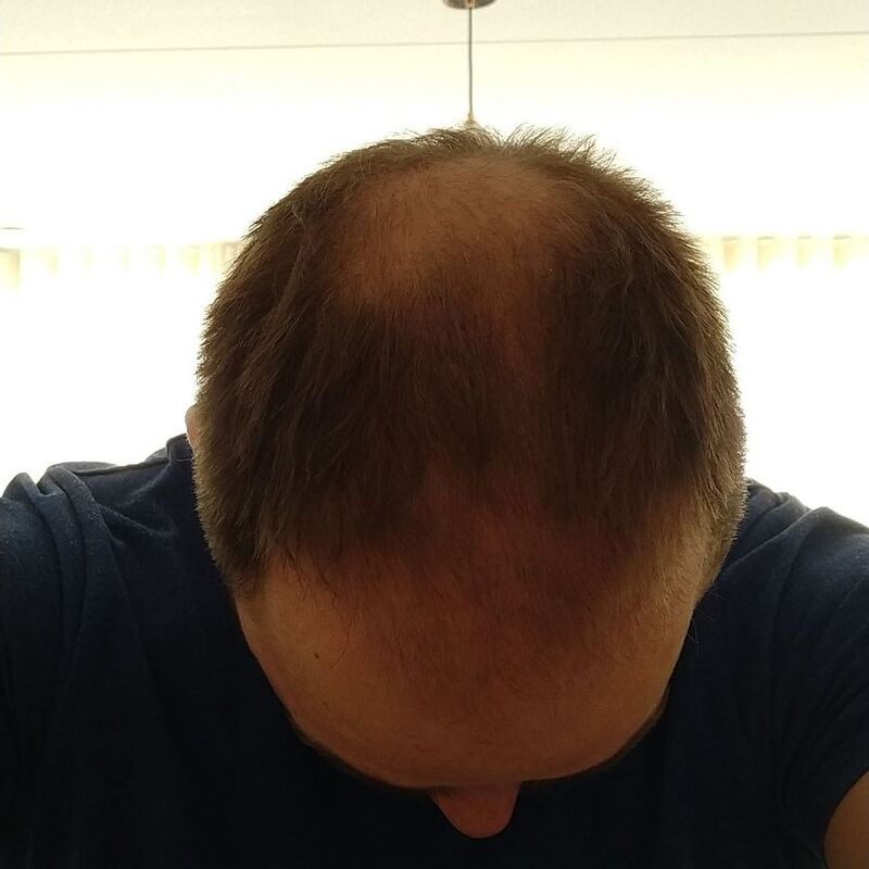 Ik wil de keuze hebben om mijn haar kort te scheren!