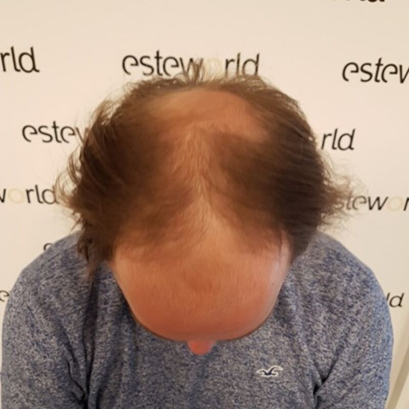 Ik wil de keuze hebben om mijn haar kort te scheren!