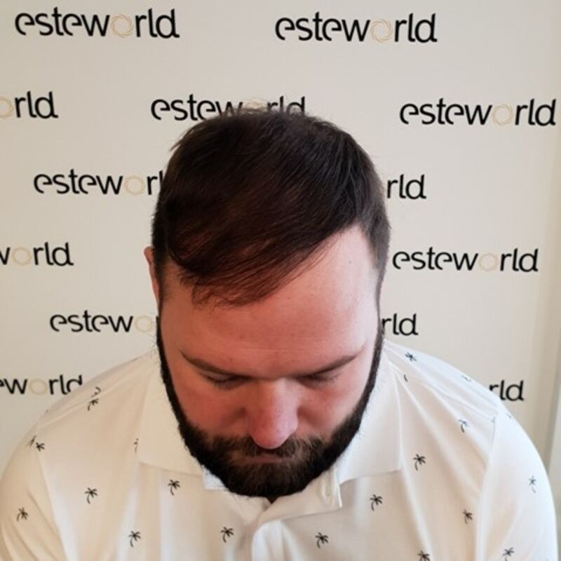 Ik wil de keuze hebben om mijn haar kort te scheren!