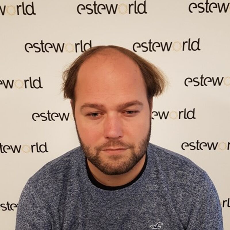 Ik wil de keuze hebben om mijn haar kort te scheren!