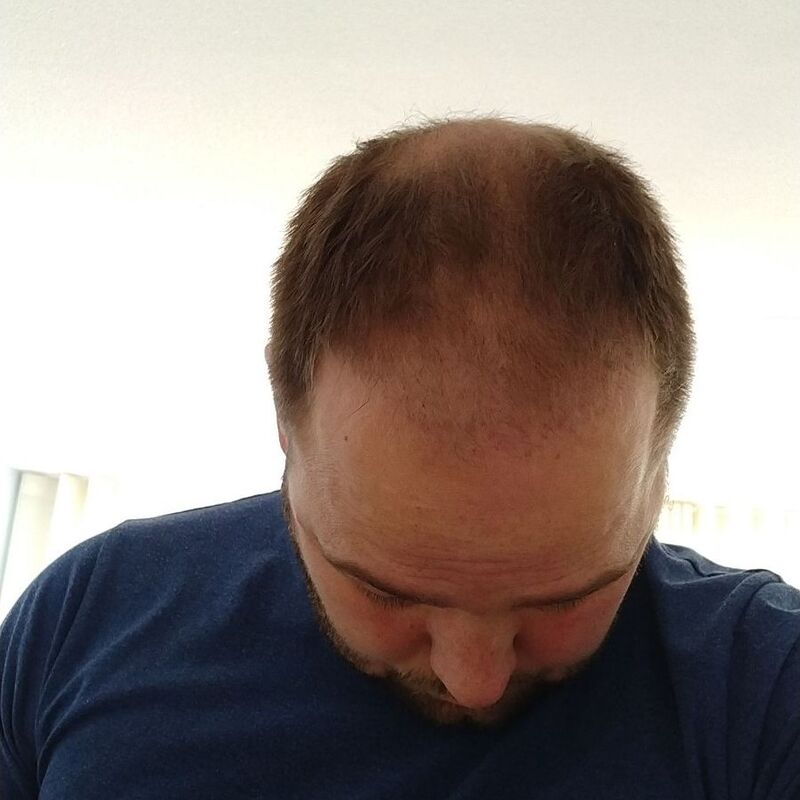 Ik wil de keuze hebben om mijn haar kort te scheren!