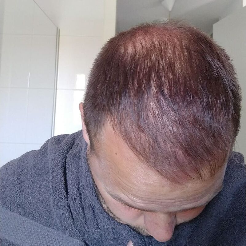 Ik wil de keuze hebben om mijn haar kort te scheren!