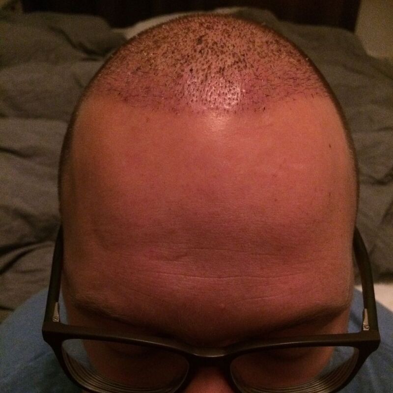 Ik wil de keuze hebben om mijn haar kort te scheren!