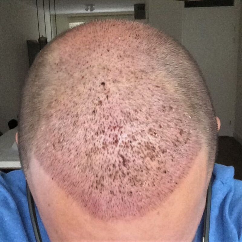 Ik wil de keuze hebben om mijn haar kort te scheren!