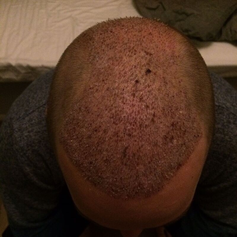 Ik wil de keuze hebben om mijn haar kort te scheren!