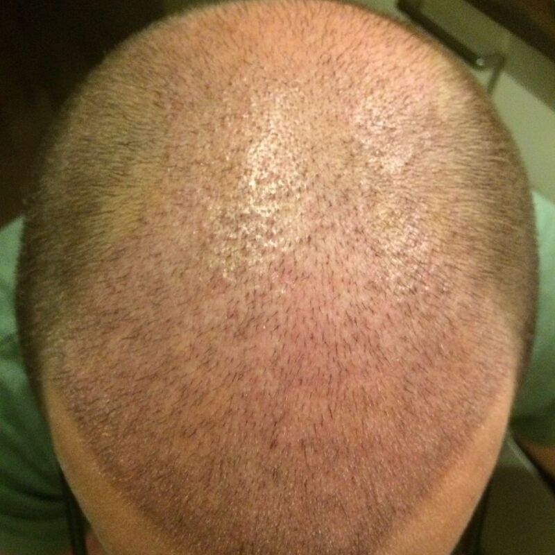 Ik wil de keuze hebben om mijn haar kort te scheren!