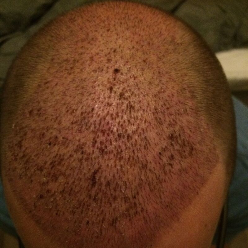 Ik wil de keuze hebben om mijn haar kort te scheren!