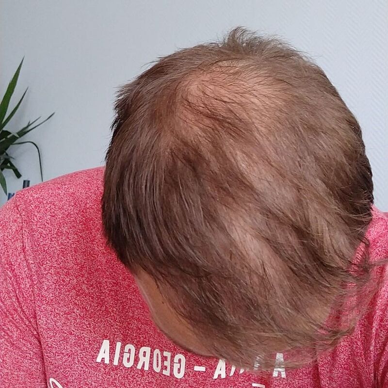 Ik wil de keuze hebben om mijn haar kort te scheren!