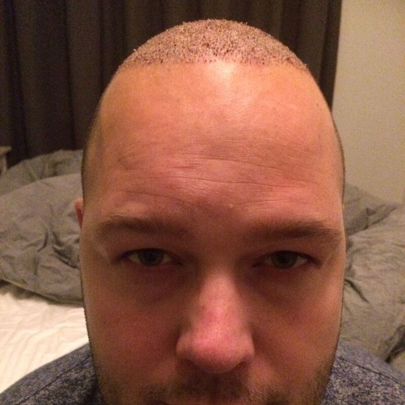 Ik wil de keuze hebben om mijn haar kort te scheren!