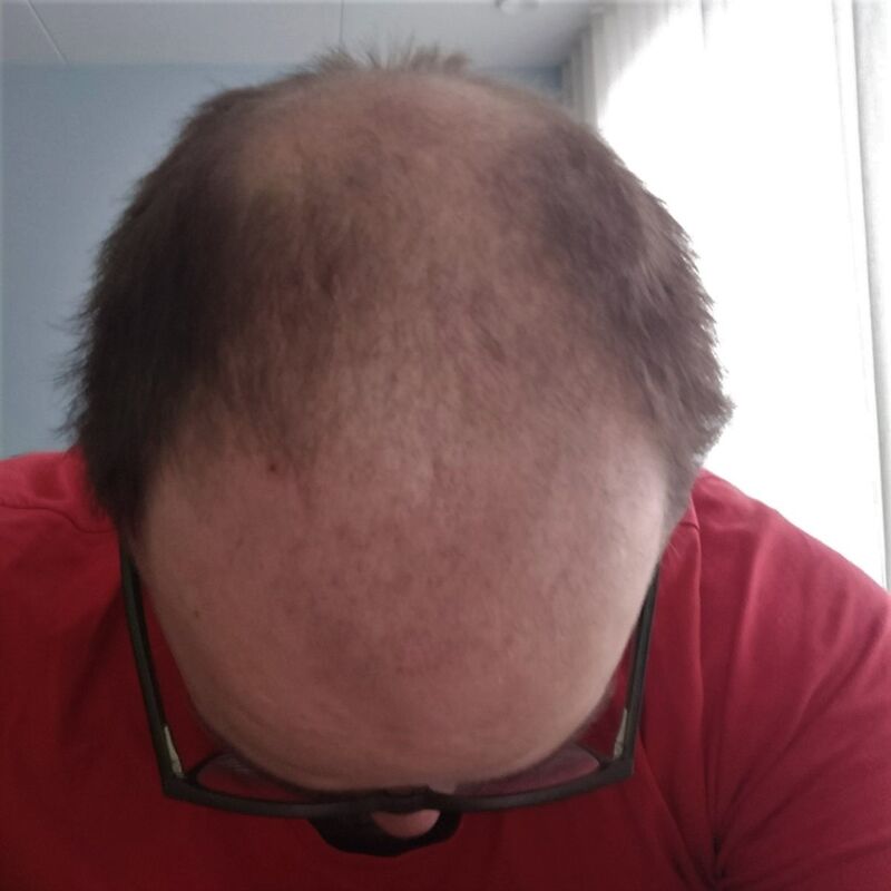 Ik wil de keuze hebben om mijn haar kort te scheren!