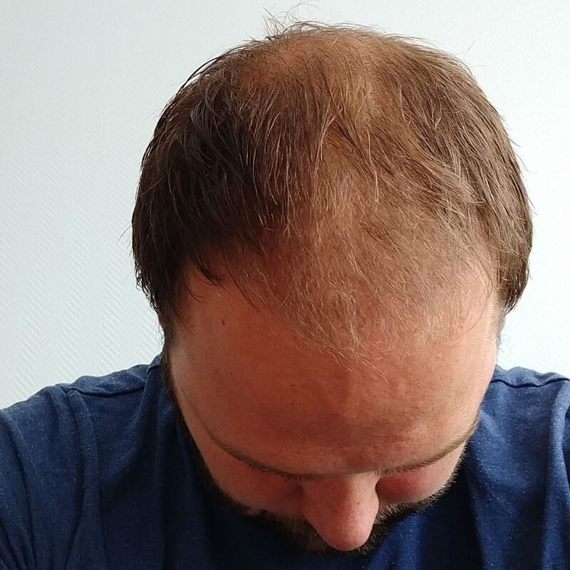 Ik wil de keuze hebben om mijn haar kort te scheren!