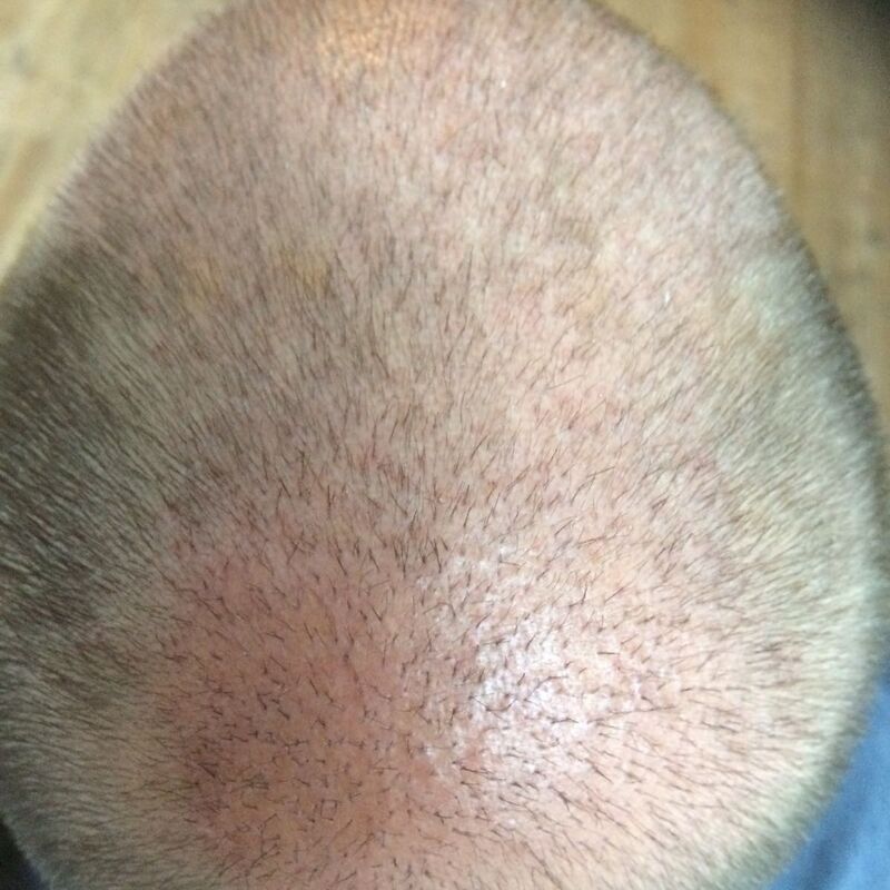 Ik wil de keuze hebben om mijn haar kort te scheren!