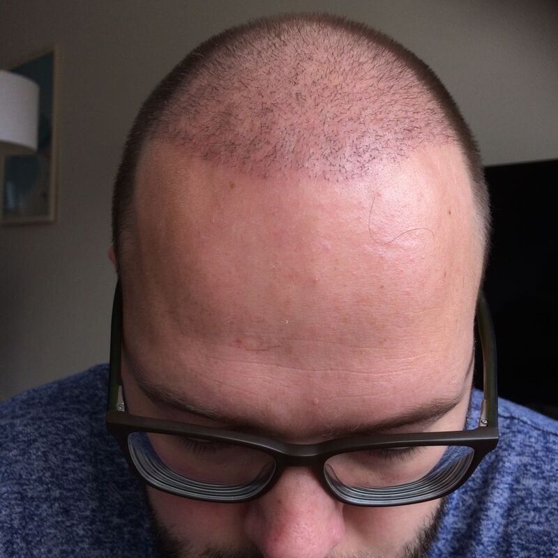 Ik wil de keuze hebben om mijn haar kort te scheren!