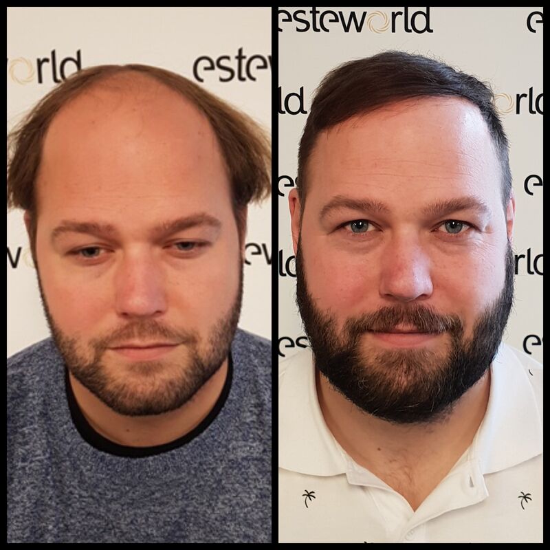 Ik wil de keuze hebben om mijn haar kort te scheren!