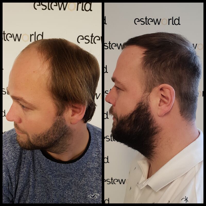 Ik wil de keuze hebben om mijn haar kort te scheren!