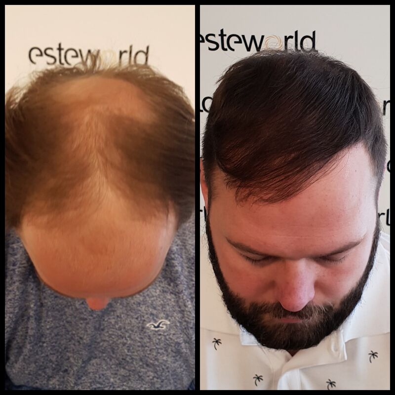 Ik wil de keuze hebben om mijn haar kort te scheren!